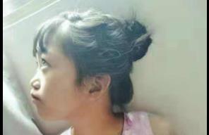 世界以痛吻我，我要报之以歌！柳州12岁女孩梁媛媛不幸离世，捐献眼角膜帮助他人