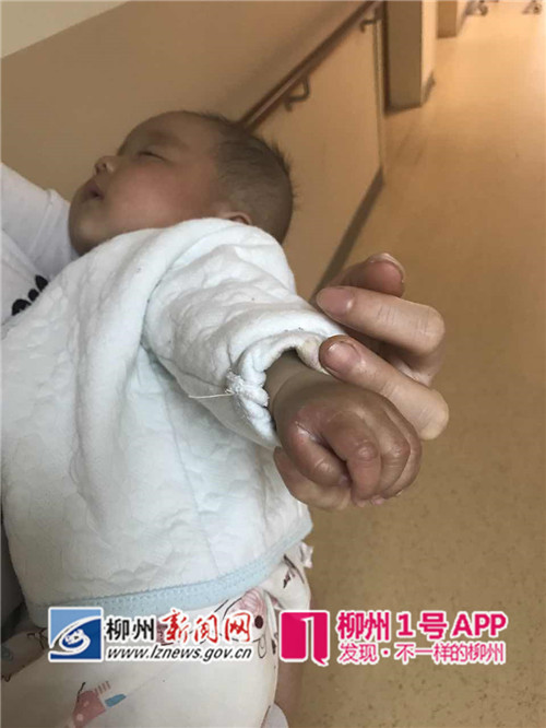 【警惕】柳州1天发生2起燃气泄漏事故，最小的伤者仅四个月大······