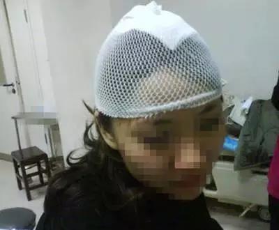 驷马况？女子在广雅路吃个夜宵，却被缝了四针！