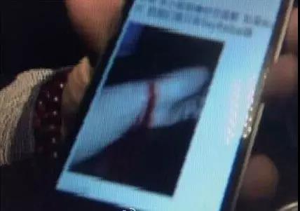 男子与老婆吵架闹割腕自杀！却因太痛了自己去医院包扎...