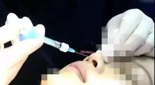 柳州妹子花三万多整容没达到预期效果，说好的貌美如花呢？
