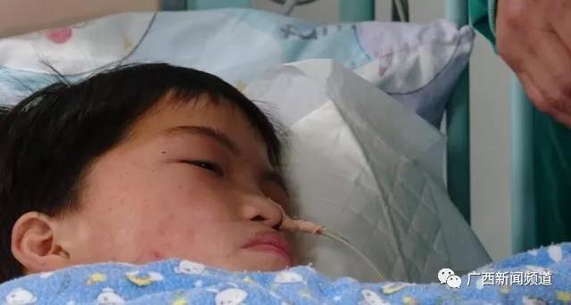 广西14岁男孩喝了“枇杷露”后不停吐血，家人一看瓶子懵了！