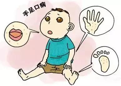 提醒|手足口病进入高发季，柳州多县区为广西防控重点
