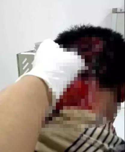 男子睡觉时后脑勺突然被炸得全是血！只因在床头放了它，家家都有