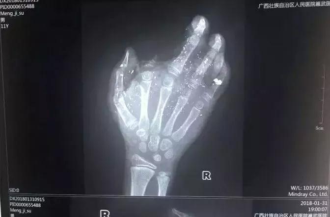 微信图片_20180625132751.jpg 微信图片_20180625132751.jpg