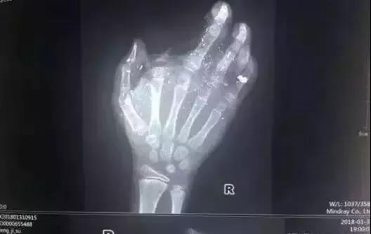 微信图片_20180702145058.jpg 微信图片_20180702145058.jpg